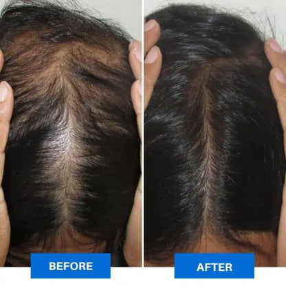 Smart Scalp Massager™ – Intelligent Electric Head Massager